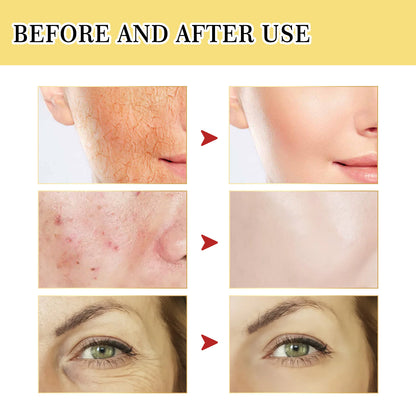 Snail  Facial Collagen Serum